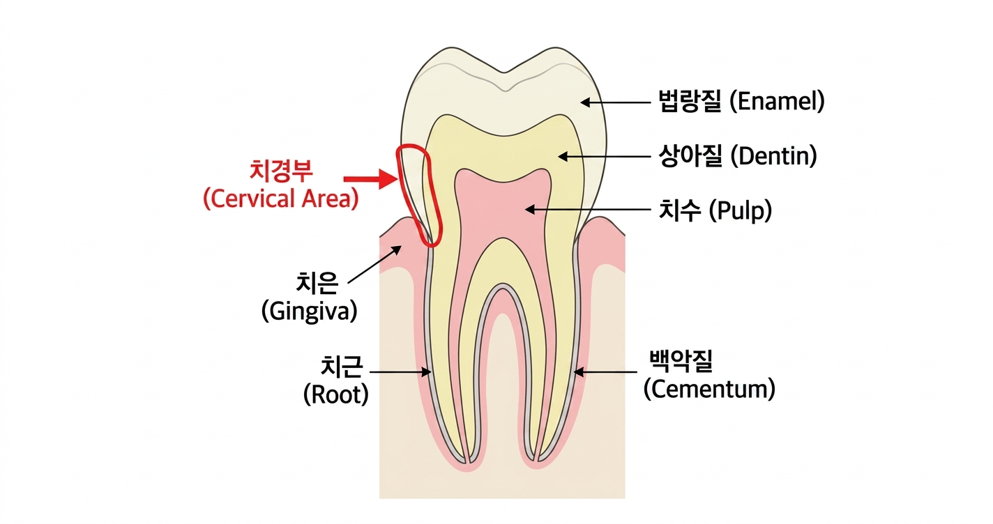 치경부 마모증 원인과 치료법 5가지 (2026)